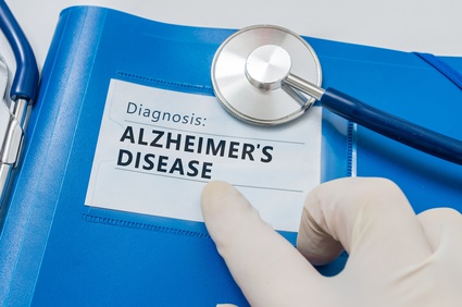 Blue folder containing Alzheimer's disease diagnosis in Dallas, TX